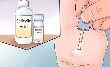 How to get rid of folklomic ways of papillomas