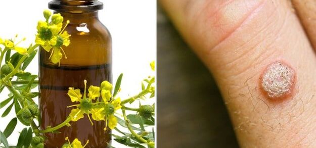wart treatment with pharmaceutical celandine